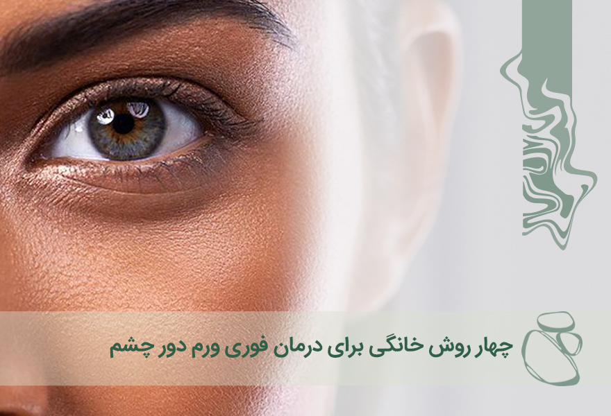 ۴ روش خانگی برای درمان فوری ورم چشم